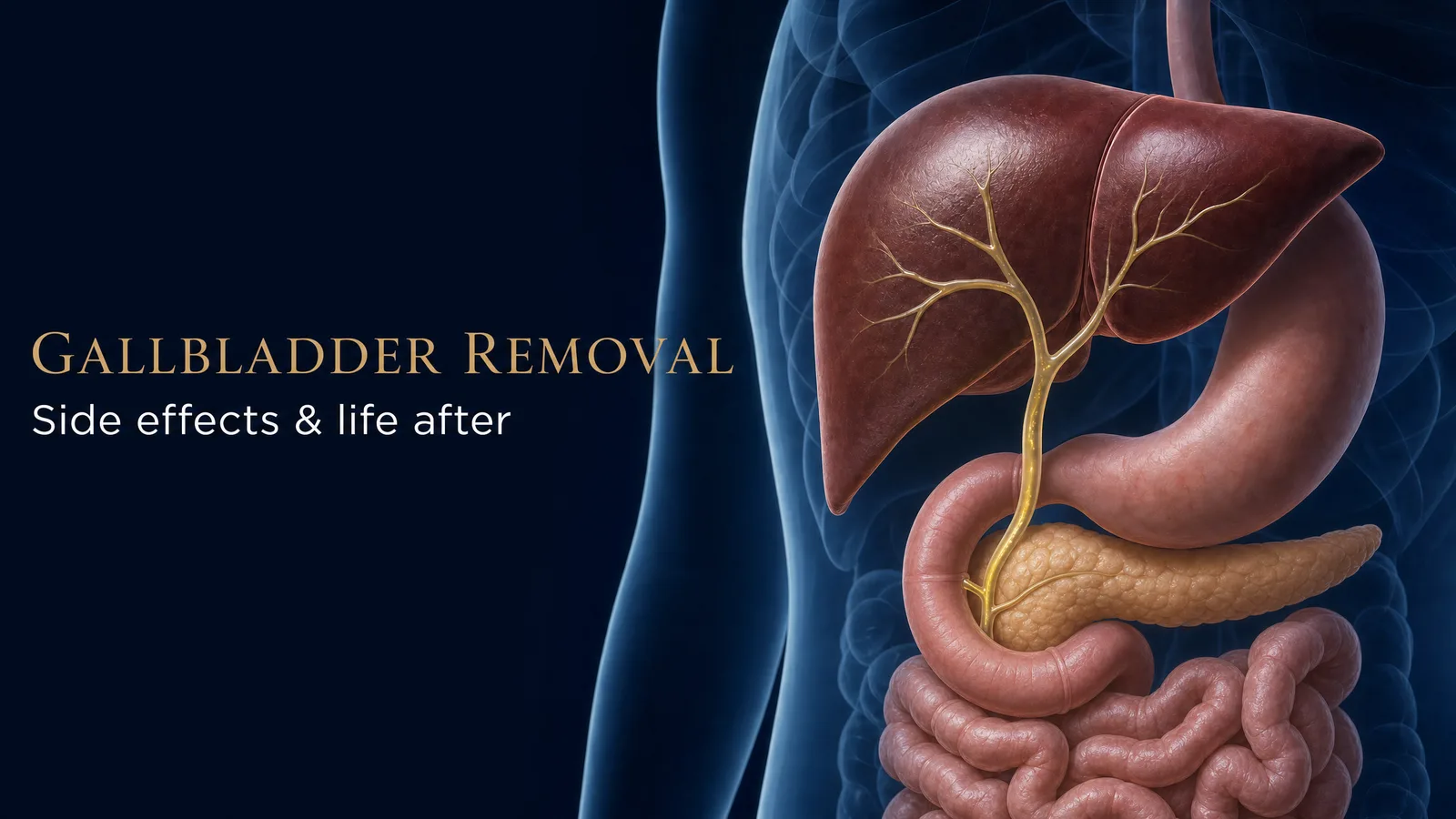 Editorial medical illustration titled Gallbladder Removal — Side effects & life after, showing the liver, bile duct and pancreas carrying bile down to the duodenum with the gallbladder absent after removal.